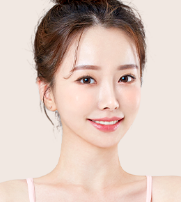 눈매교정