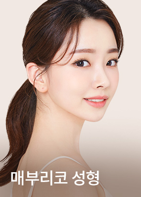 매부리코 성형